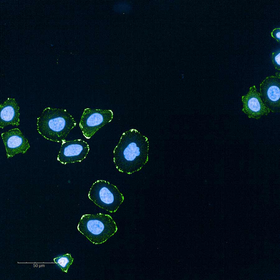 Lung cancer cells after treatment. Only a small number of green cells with blue nuclei remain scattered across the image.