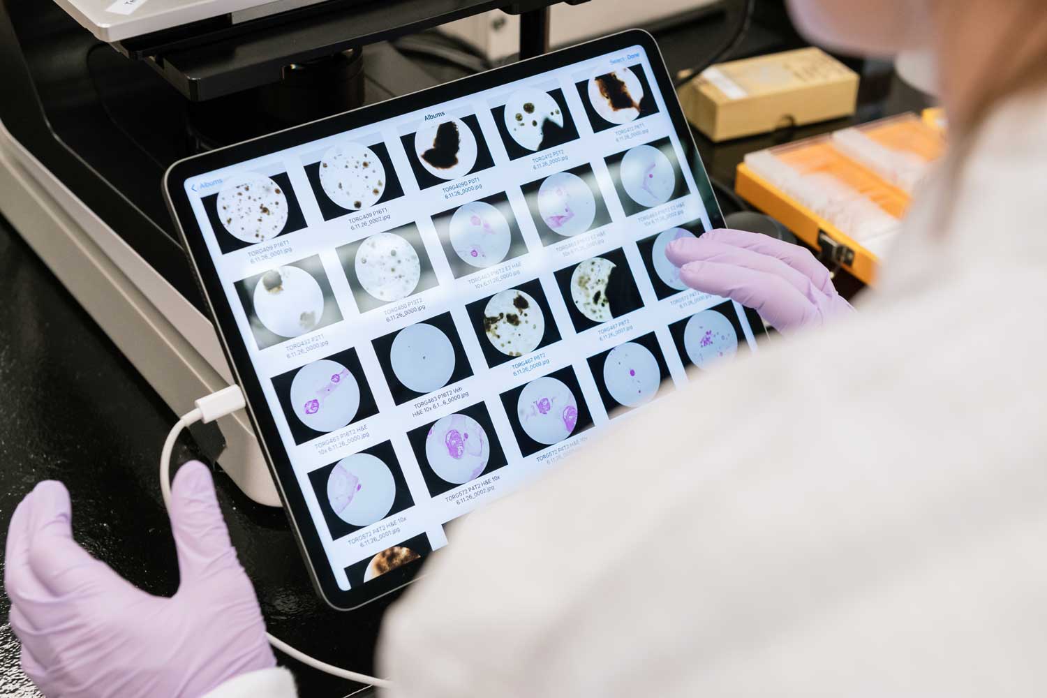 An iPad screen displaying an assortment of many organoids as seen through a microscope.