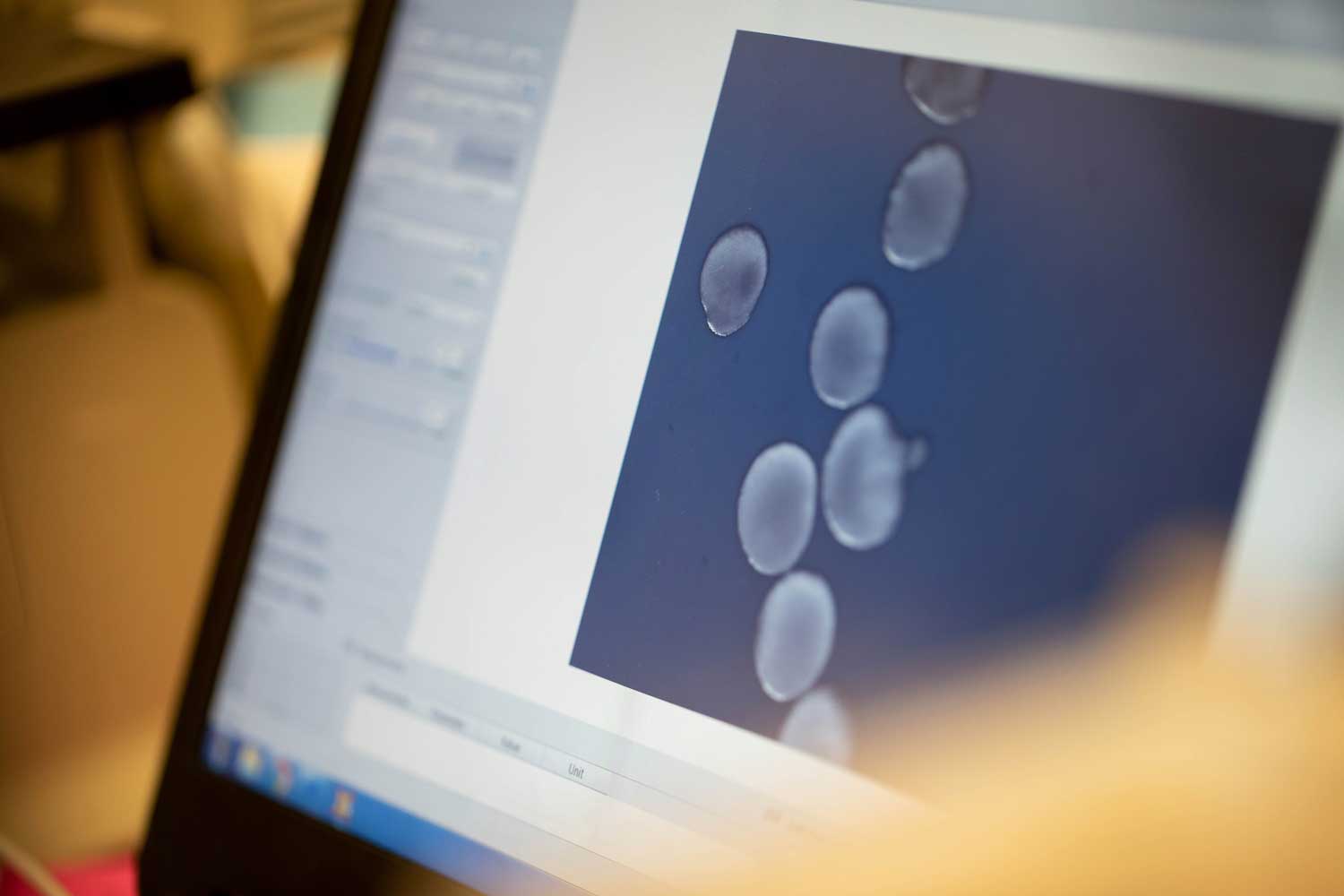 Computer screen displaying microscope images of brain organoids used for stem cell research.