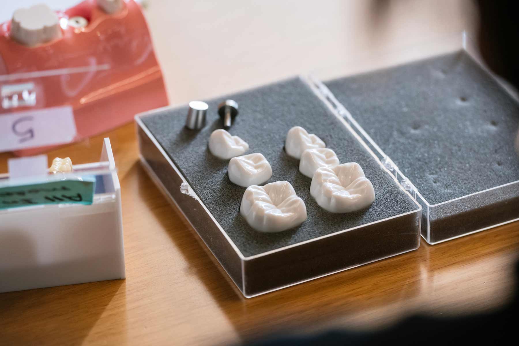 Samples of different sizes of teeth in a small case for demonstration.