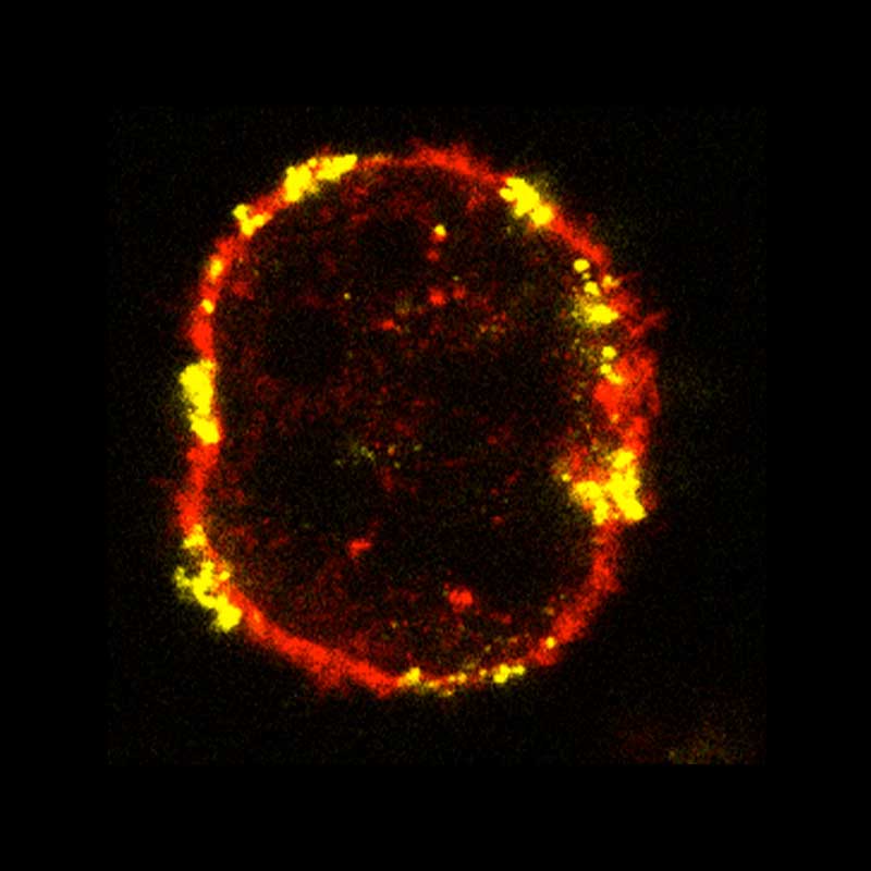 Microscopy image of a single dendritic cell in red with absorbed tumor cell fragments highlighted in yellow.