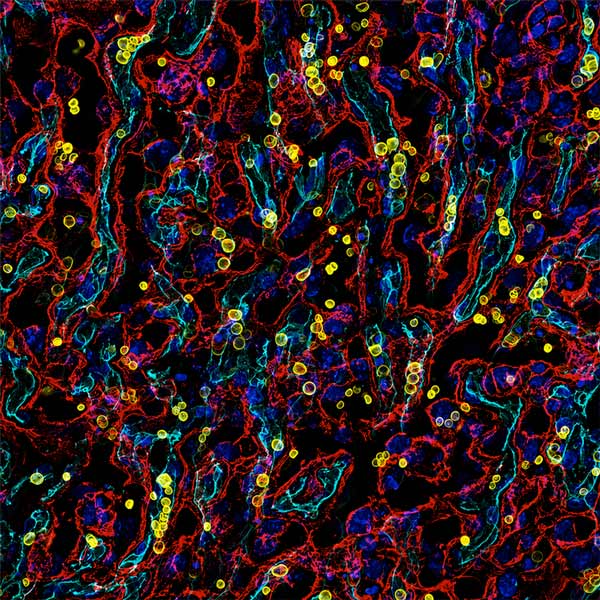 Fluorescent microscopy image of mouse placenta tissue showing trophoblasts in red, fetal blood vessels in light blue, red blood cells in yellow, and cell nuclei in dark blue.