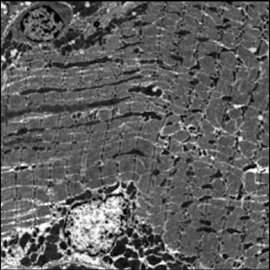 Microscopy image of diaphragm muscle showing macrophages as dark spots among densely packed muscle fibers.