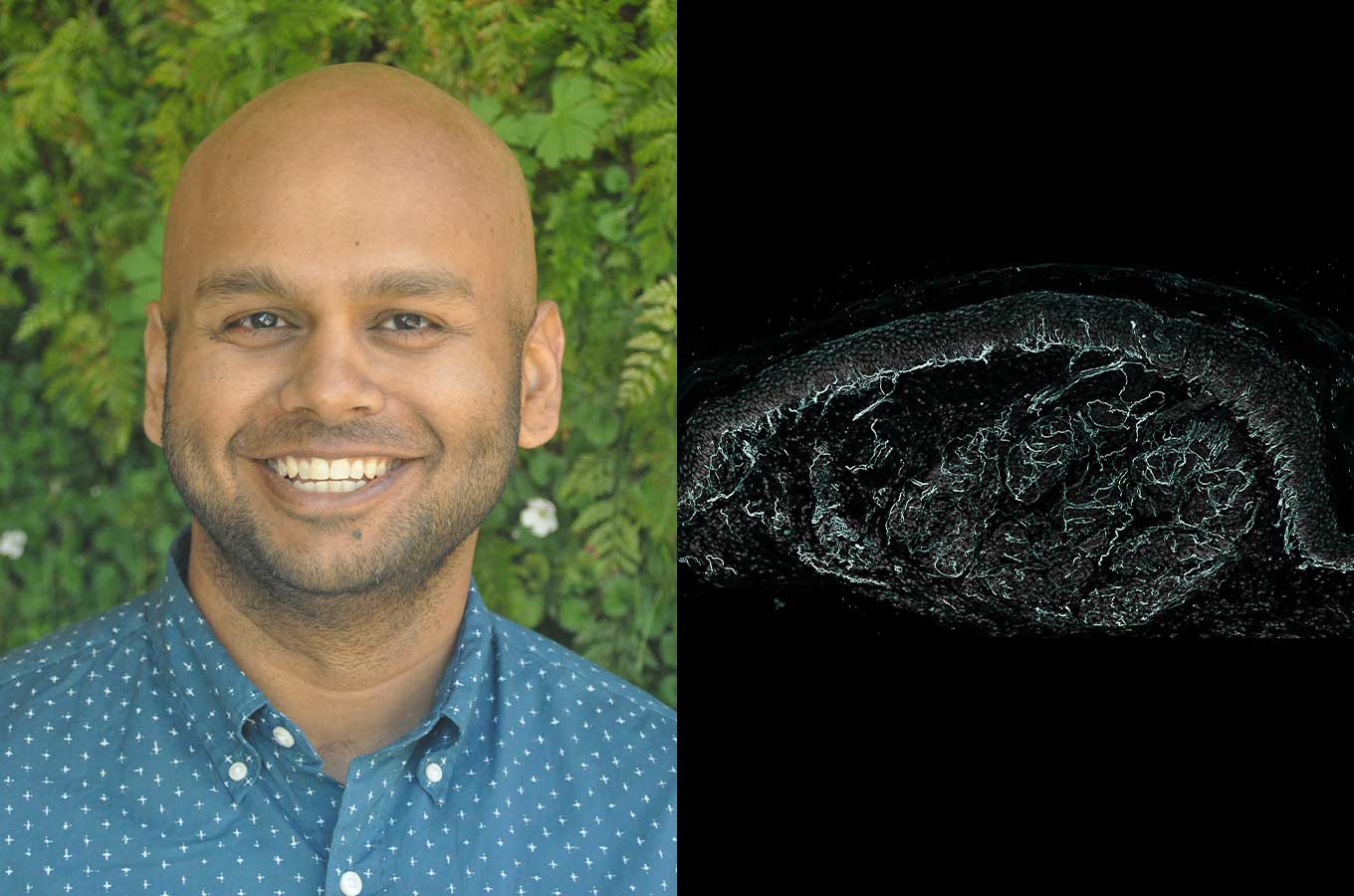 A composite image of Sakeen Kashem's headshot and a microscopic image of a skin nerve.