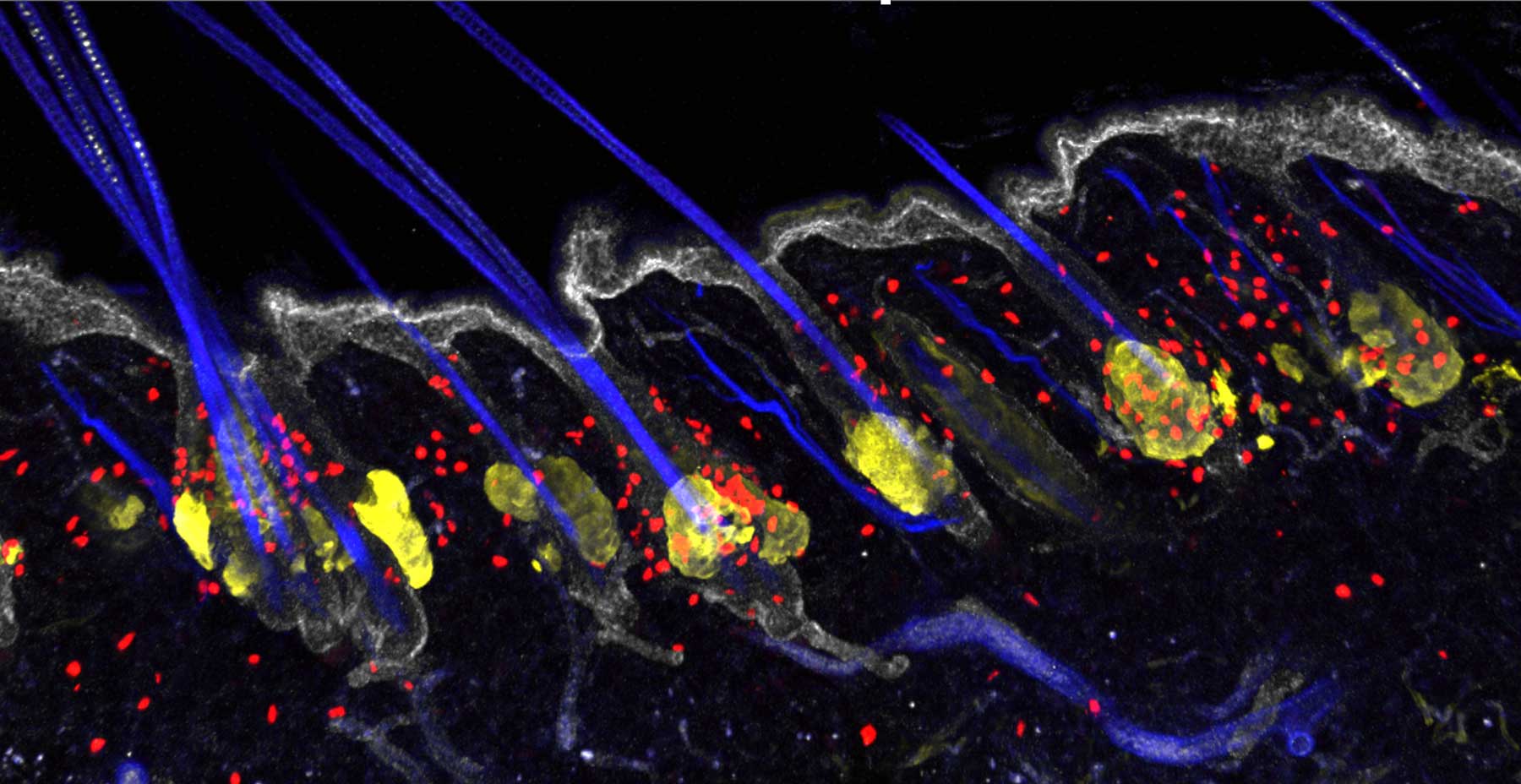 Fluorescent microscopy image of mouse ear skin showing many memory T-cells in red remaining after inflammation subsided.
