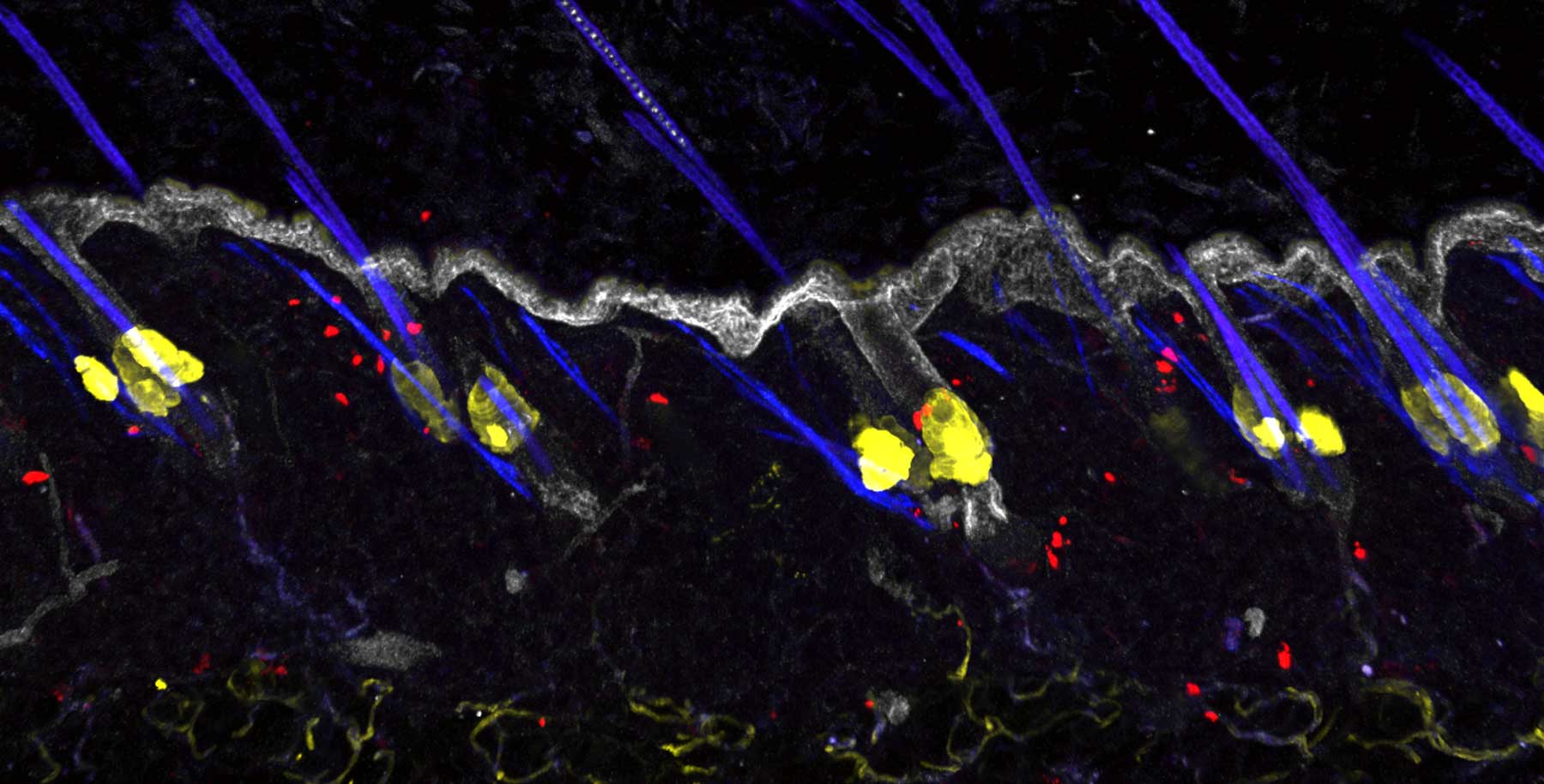 Fluorescent microscopy image of mouse ear skin showing few memory T-cells in red after inflammation subsided.