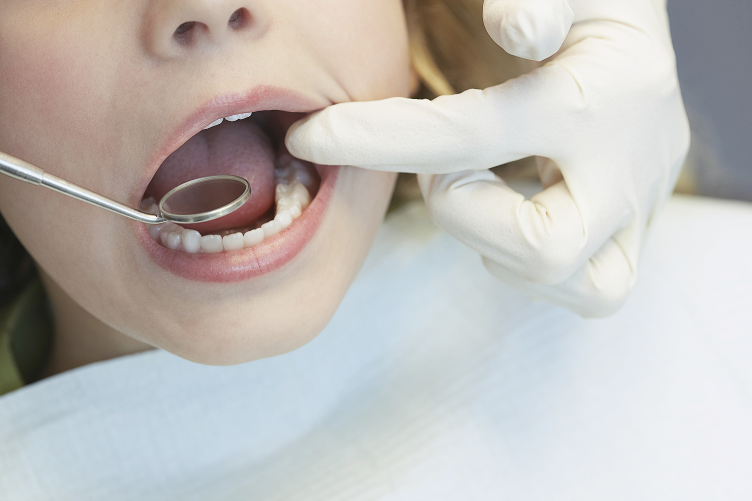 Assessing Risk Helps Dentists Tailor Preventive Treatments for Young ChildrenUC San Francisco