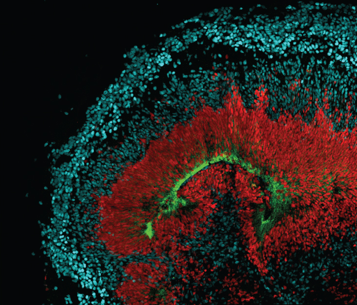 microscopic image of a human cortex organoid