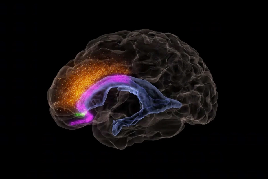 colorful illustration of human brain