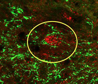 This image shows the interconnectedness of the transplanted cells (green) and the neurons of the host (red). 