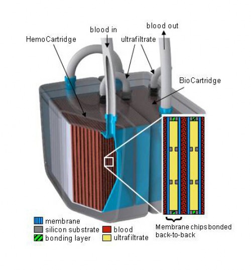 Diagram of the artificial kidney