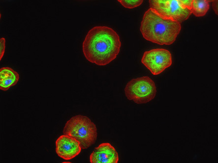 Cytoskeletons. In these cells a major component of the cytoskeleton, called microtubules, are stained green. Another component of the cytoskeleton, the actin filaments, are stained red.