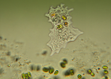 amoeba micrograph