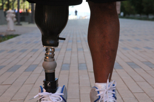 Iraq War veteran David Ladd, who lost his right leg during the war