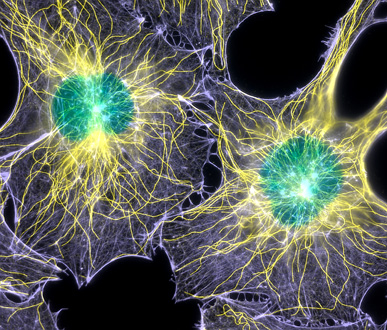 Mouse fibroblasts stained for actin (blue), microtubules (yellow), and nuclei (green).