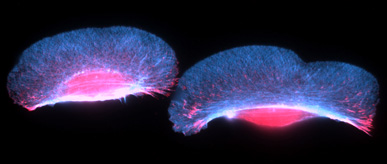 Migrating goldfish skin keratocytes stained for actin (blue) and adhesion sites (red).