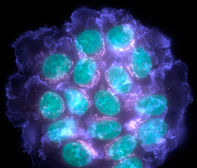 Growth factor stimulated human breast cancer cells stained for actin (blue), nuclei (green) and the Golgi apparatus (purple).