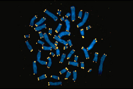 DNA caps called telomeres (yellow) protect gene-bearing chromosomes (blue)