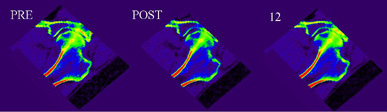 Illustration of computed tomography images