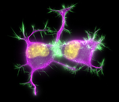 Differentiating neuroblastoma cells stained for microtubules (purple), actin (green).