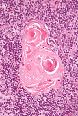 Science image of Hassall’s corpuscles