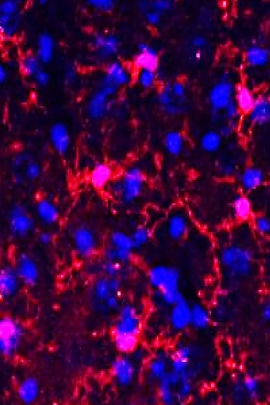 Healthy microglia (red) in mouse brain. Blue stain is cell nuclei for anatomical reference. Credit: Rosi lab / UCSF