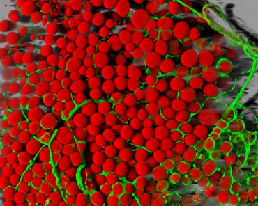 A mouse's fat cells are shown surrounded by a network of blood vessels.