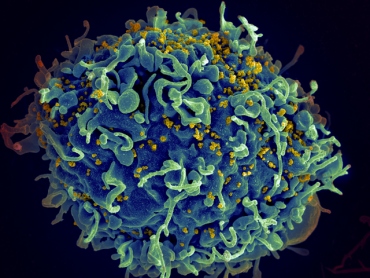 An HIV-infected T cell.