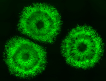 Three green organoids composed of immature inhibitory neuron precursors