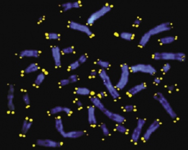 Telomeres are shown in yellow at the ends of chromosomes