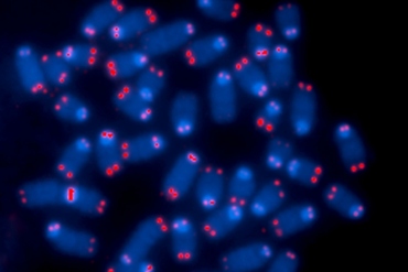 telomeres are shown at the end of chromosomes