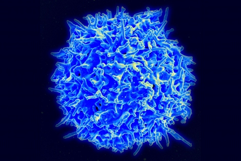 microscopic image of a human T cell