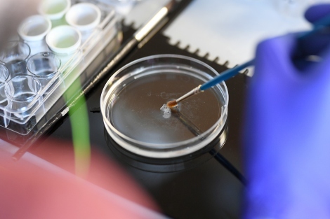 a researcher prepares brain tissue samples in a petri dish