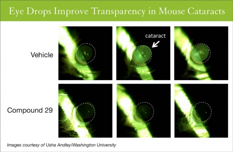 Eye drops  improve transparency in mouse cataracts