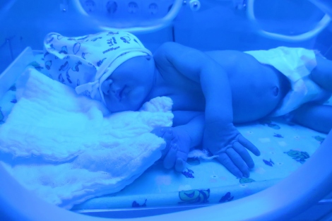 A stock image shows a newborn receiving phototherapy