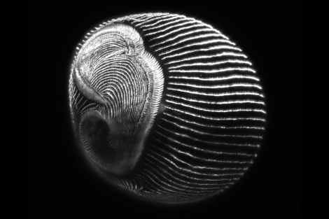 a microscopic image of a Stentor