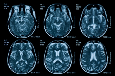 six brain scans