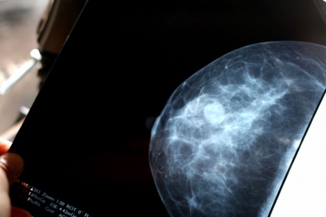 A file image shows a breast scan