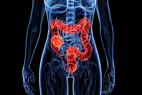 stock illustration of a transparent female body with colon highlighted