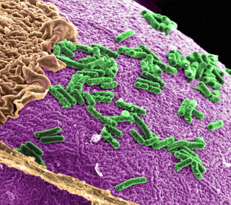 microscopic view of gut bacteria