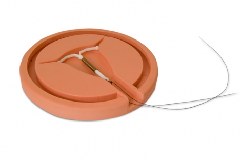 an IUD device