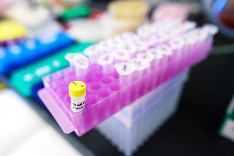 lab samples in vials
