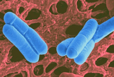 lactobacillus is shown in a microscopic image
