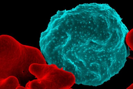 a cell infected with malaria 