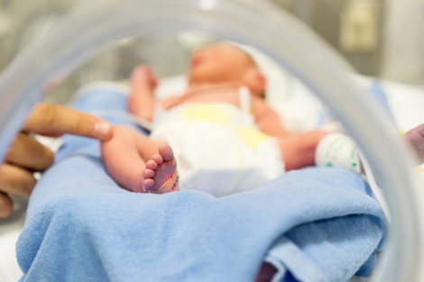 a stock image shows a preterm newborn baby