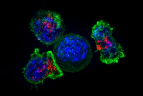 microscopic image of T cells attacking a cancer cell