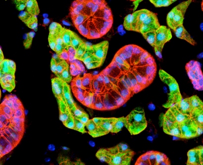healthy mouse salivary gland with acinar cells labeled in green and ductal cells labeled in pink