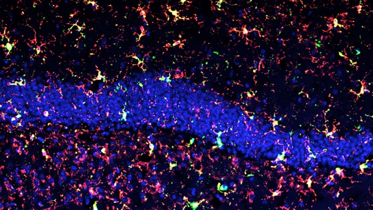 Reactive microglia (red+green specks) in irradiated mouse hippocampus. Blue stain is cell nuclei for anatomical reference. Credit: Rosi lab / UCSF