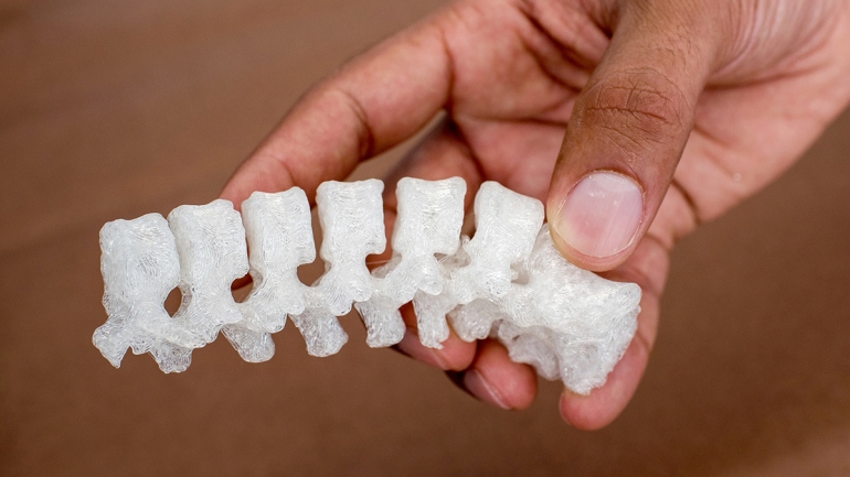 a hand holds a 3-D printed model of a spine