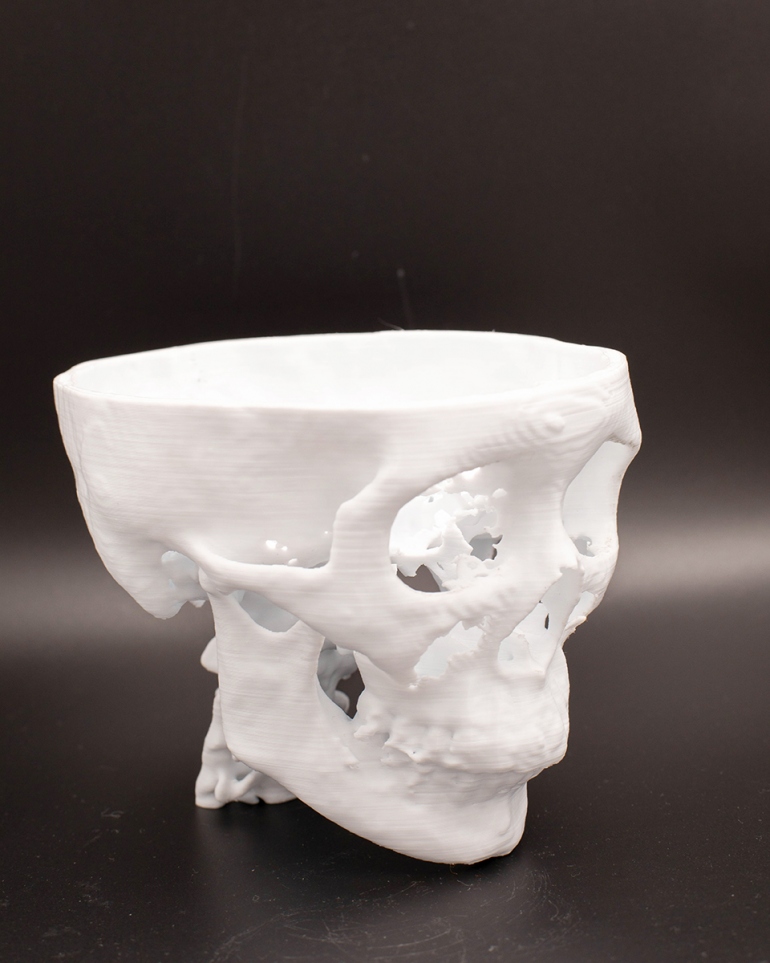 a 3-D printed model of a human skull